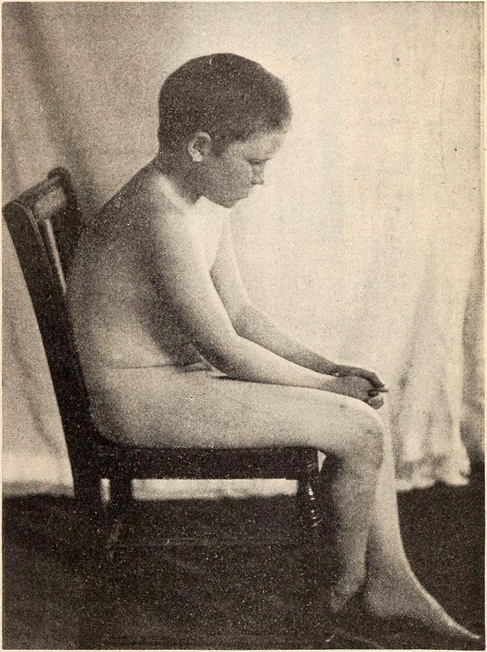 Influence of weight of arms and head on shape of back in sitting posture (Common posture of child at study) / Влияние веса рук и головы на форму спины в сидячем положении (обычная поза ребенка во время учебы)