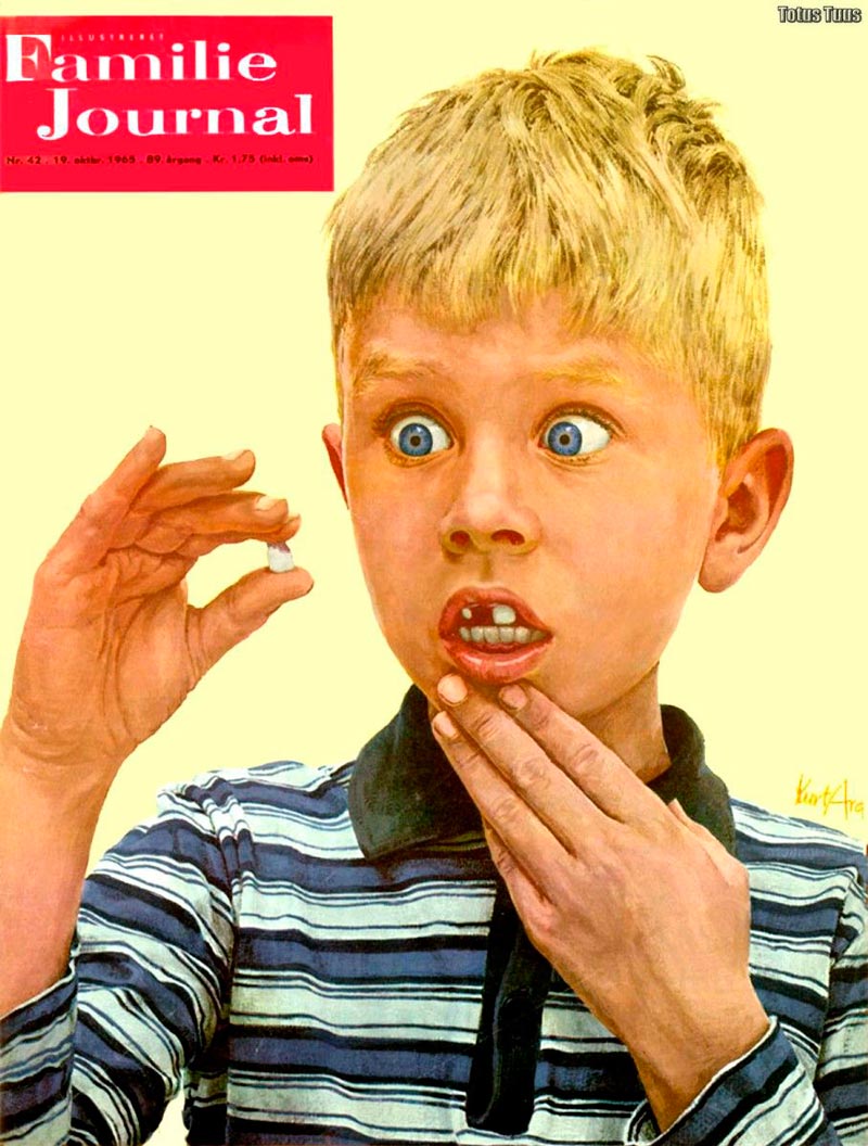 Lost Tooth! (Выпавший зуб!), 1965