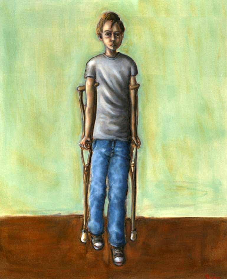 Boy on Crutches (Мальчик на костылях)