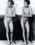 Two figures of naked boys