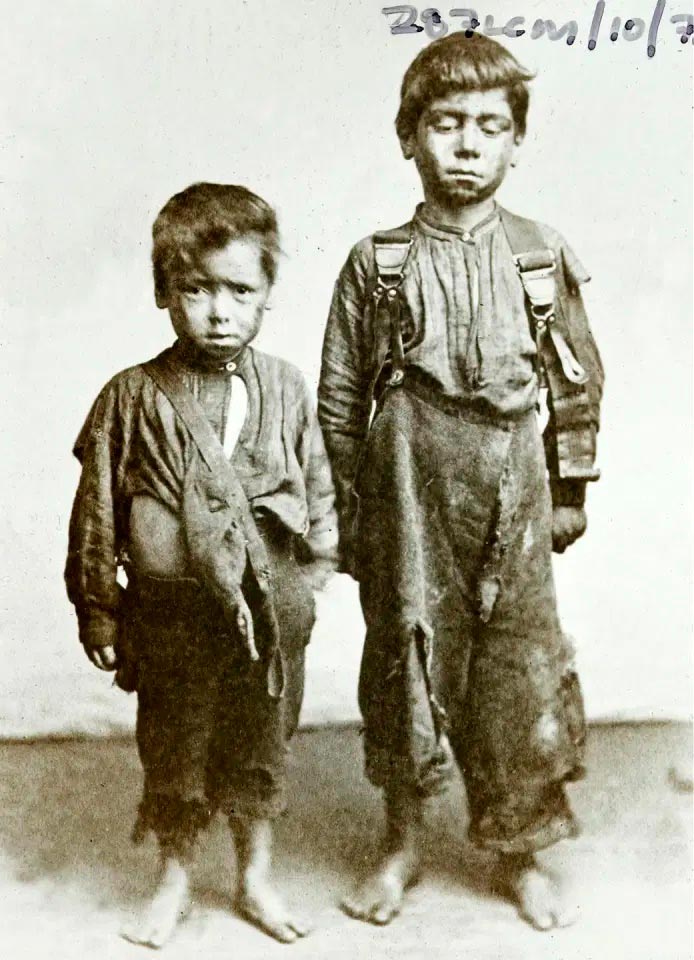 Two bare-footed and filthy looking young boys pose for a picture (Два грязных босоногих паренька, позирующих для фото), 1880s