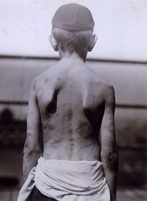 Battered Child (Избитый ребёнок), c.1910