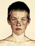 from series FRECKLES * из серии ВЕСНУШКИ, 2013