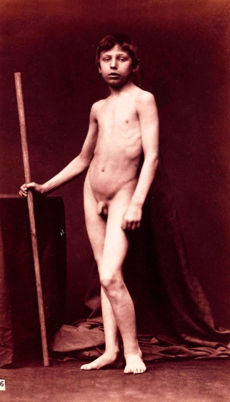 Nu masculin (Обнажённый юноша), 1870s