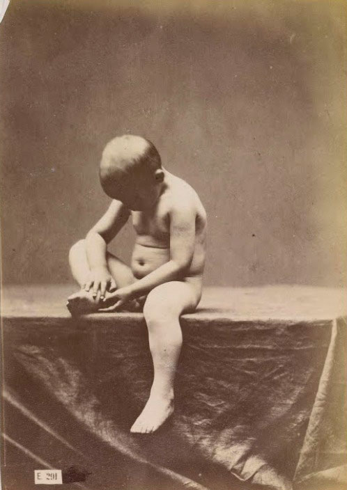 Study of a naked child who gets a splinter out of the foot (Эскиз голого ребёнка, вытаскивающего занозу из ноги), c. 1880-1882