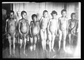 Starving children at collecting hospital