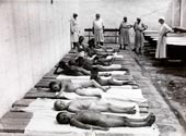 Children waiting to take medicinal baths