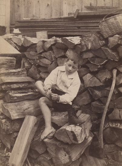 In trouble-boy on stump with sore foot (Заноза - мальчик, сидящий на поленьях, достаёт занозу), 1906