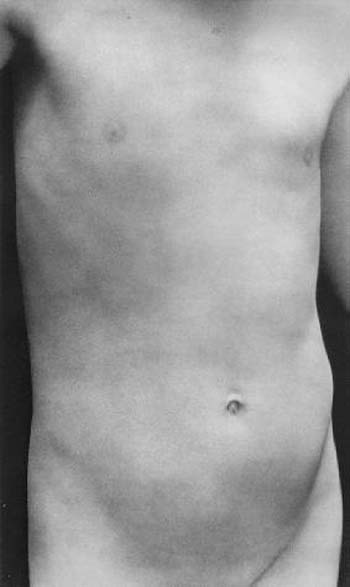 Torso of Neil (Торс Нейла), 1925