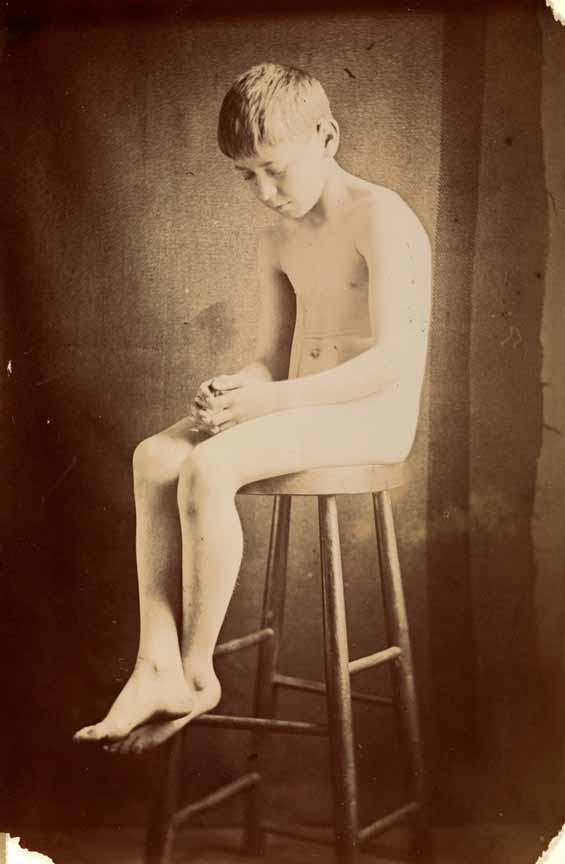 Boy nude, sitting on stool, in studio (Голый мальчик, сидящий на стуле в студии), c.1910