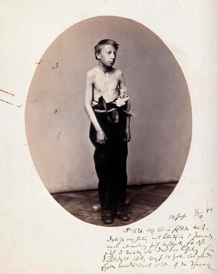 A boy, standing, viewed in full length, naked to the waist (Стоящий мальчик, в полный рост, голый по пояс.), 1856